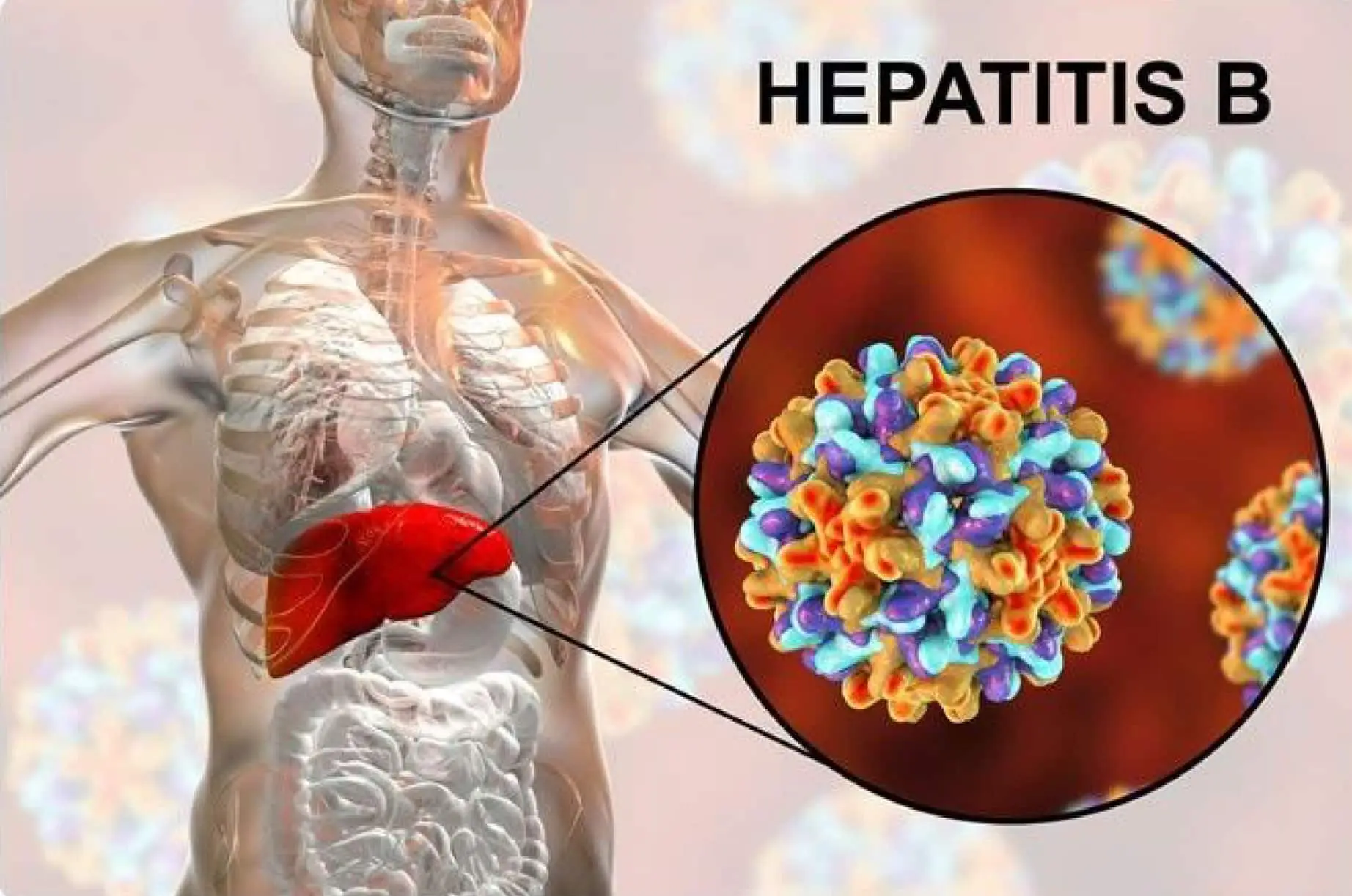 Hepatitis image-3a